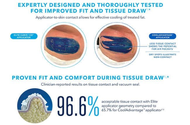 Cold vs. Hot: Comparing Modalities for Body Sculpting - Van Raalte, Ben  ()